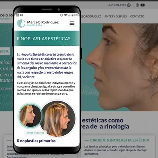 Caso de exito: drrodriguezrinoplastia.com.ar